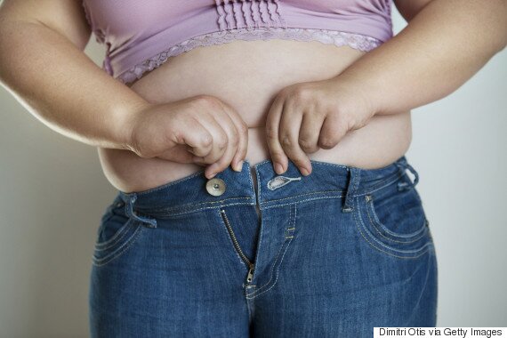 Weight loss surgery ‘could cure type-2 diabetes’ photo